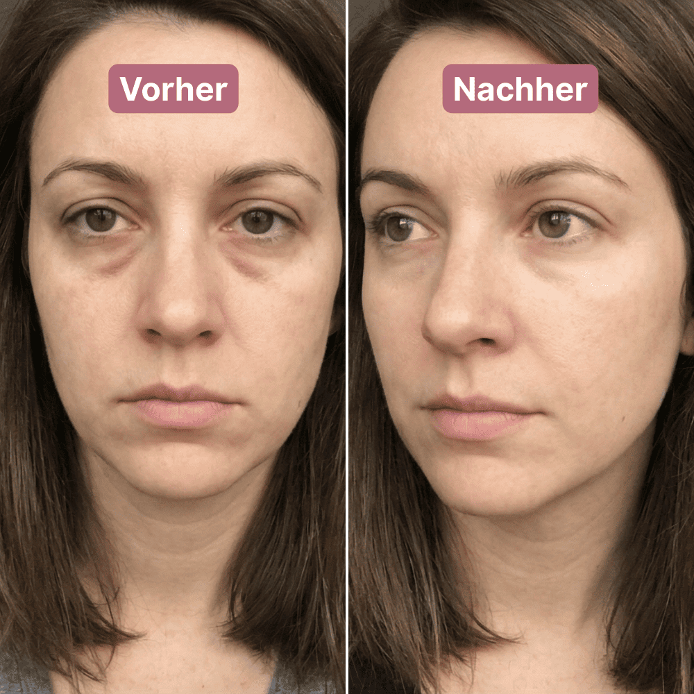 DermaGlow Eye Patches™